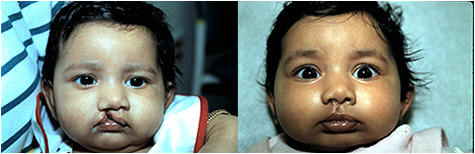 before-after1