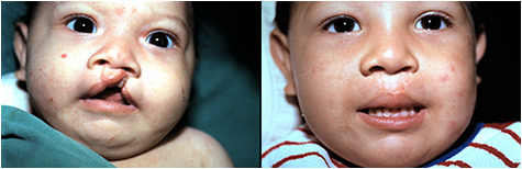 before-after2