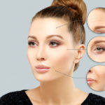 botox la jolla