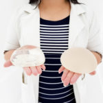 patient with smooth implants